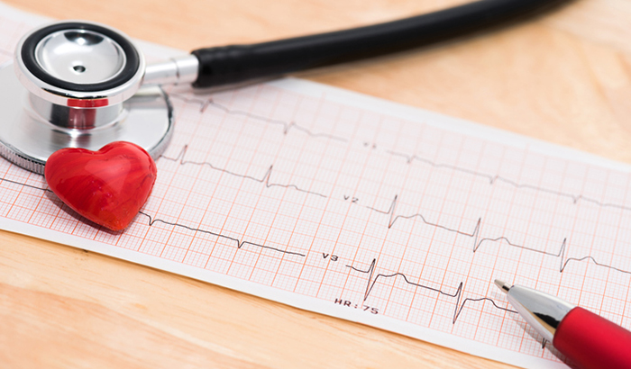 An ECG heart monitor printout with a stethoscope 