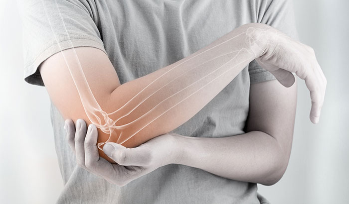  Musculoskeletal Diagnoses Cohort: Examining Pain and Pain Care in VA